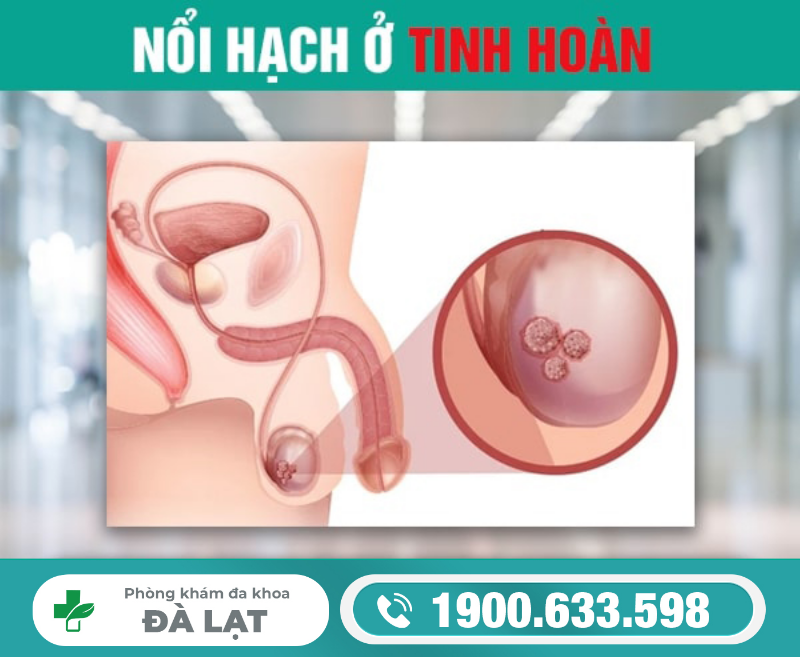 Hình ảnh minh họa